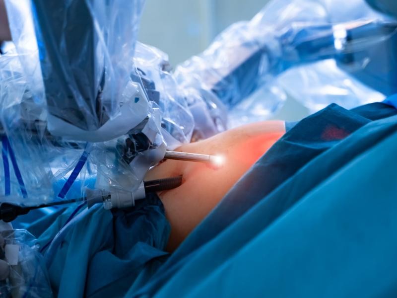 Cirurgia Bypass Gástrico Robótico